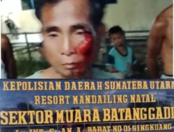 Terduga Pelaku Pengeroyokan Masih Bebas Berkeliaran, Korban Minta Aparat Penegak Hukum Tangkap Pelaku